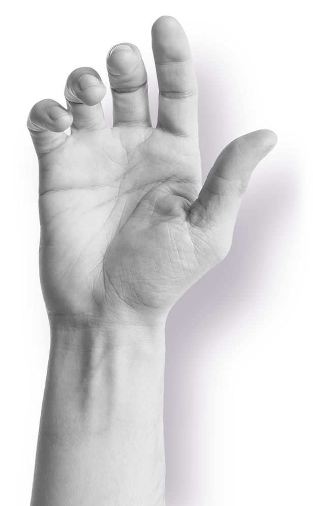 Hand and wrist treatment with Sonex