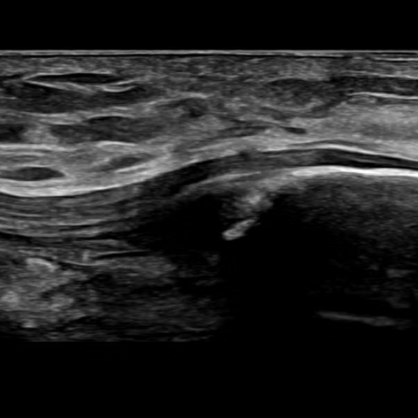 Musculoskeletal ultrasound exam at Mississippi Motion